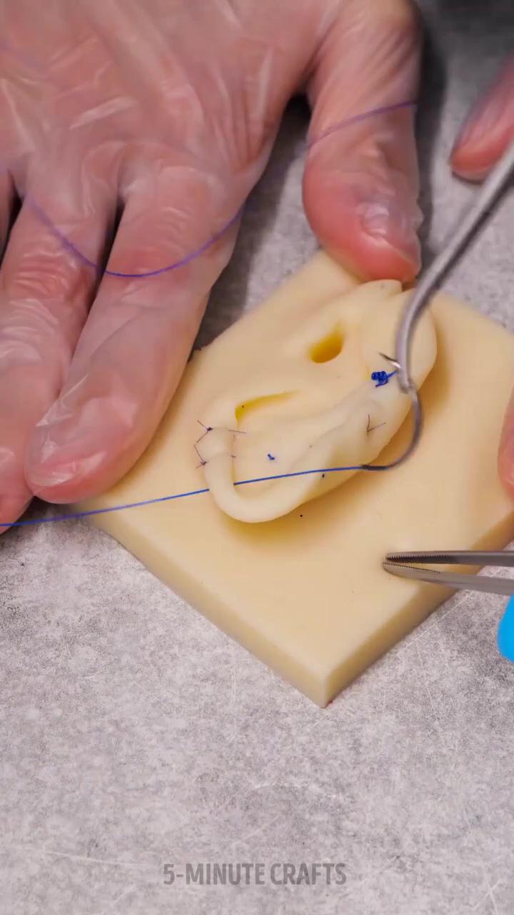 Surgery sewing and suturing techniques; anemia