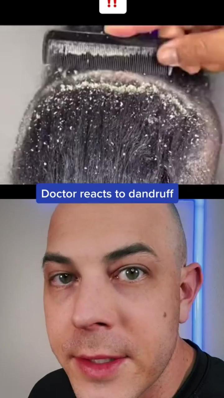 Doctor reacts to bad dandruff; doctor reacts to "amazing" pedicure