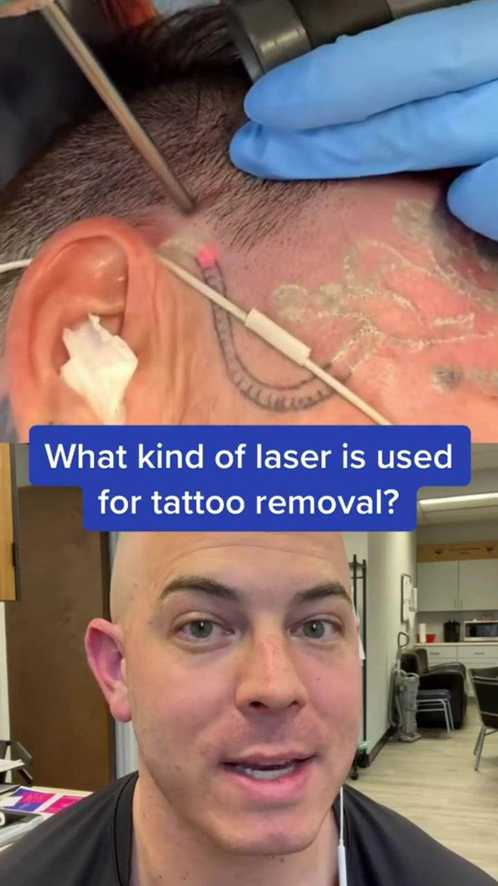 Doctor reacts to funny tattoo removal #laser #tattoo #dermreacts; tattoo videos